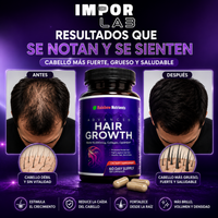Hair Growth Complex | Suplemento para Cabello| 120 Cápsulas